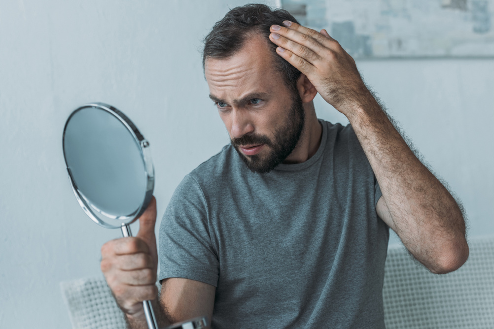 Autotrapianto di capelli