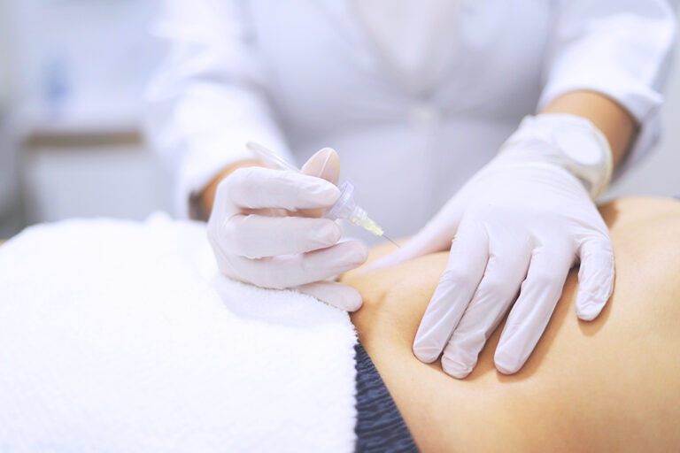 Carbossiterapia medicina estetica