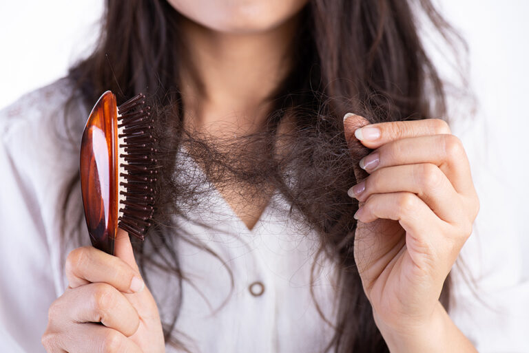 Caduta dei capelli