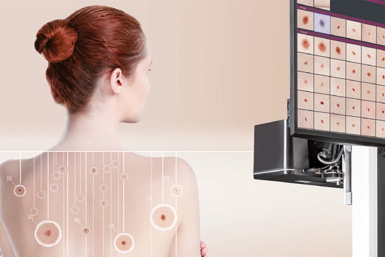 Maggio mese del melanoma