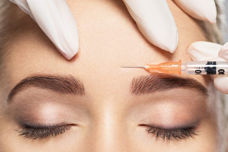 trattamento preventivo con tossina botulinica